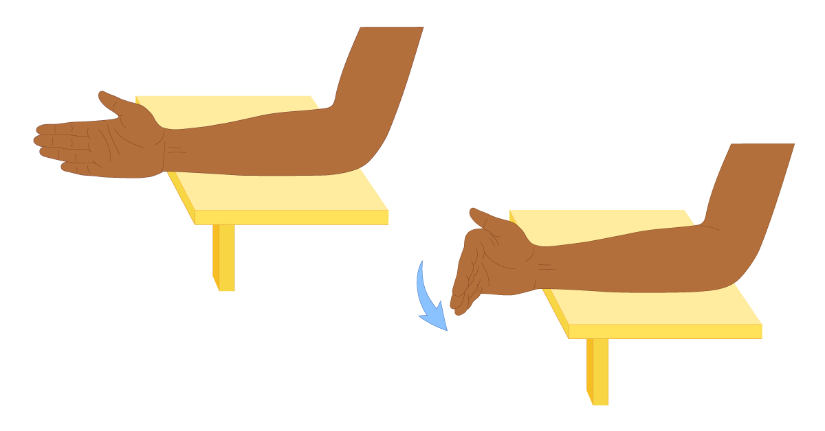 10 Simple Broken Wrist Rehab Exercises for a Quick Recovery