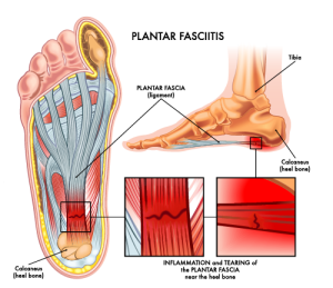 Crossover Plantar Fascia Stretch - Sporty Doctor
